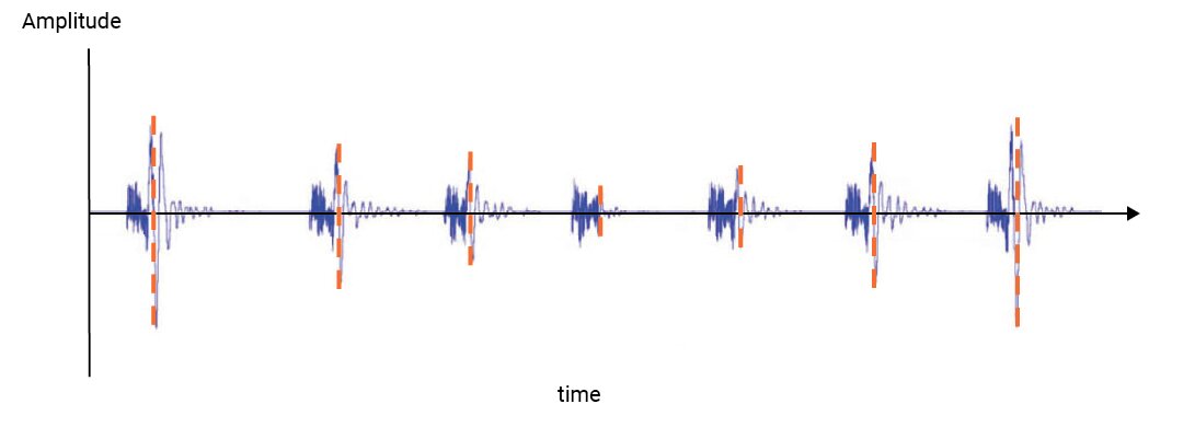 Xbox Elite Transient Response Output - Palm