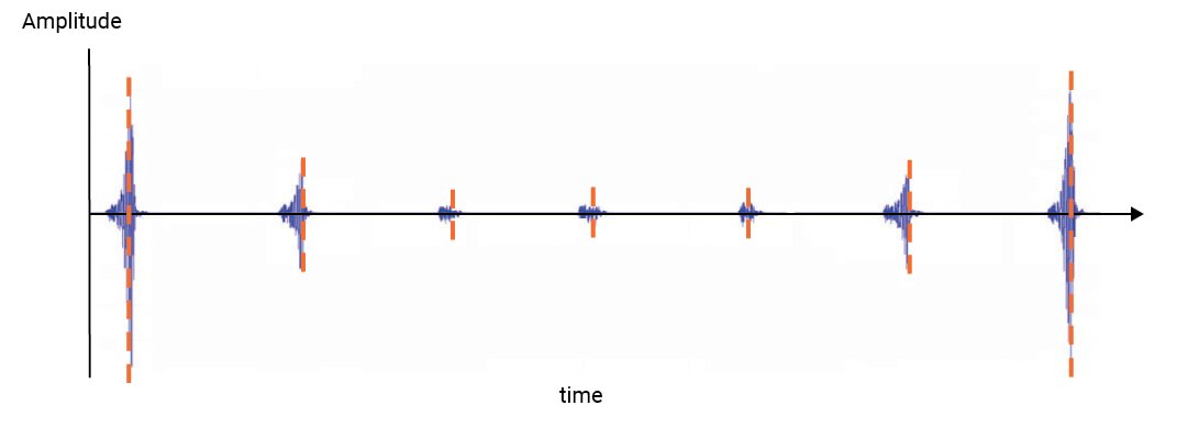 Xbox Elite Transient Response Output - Trigger